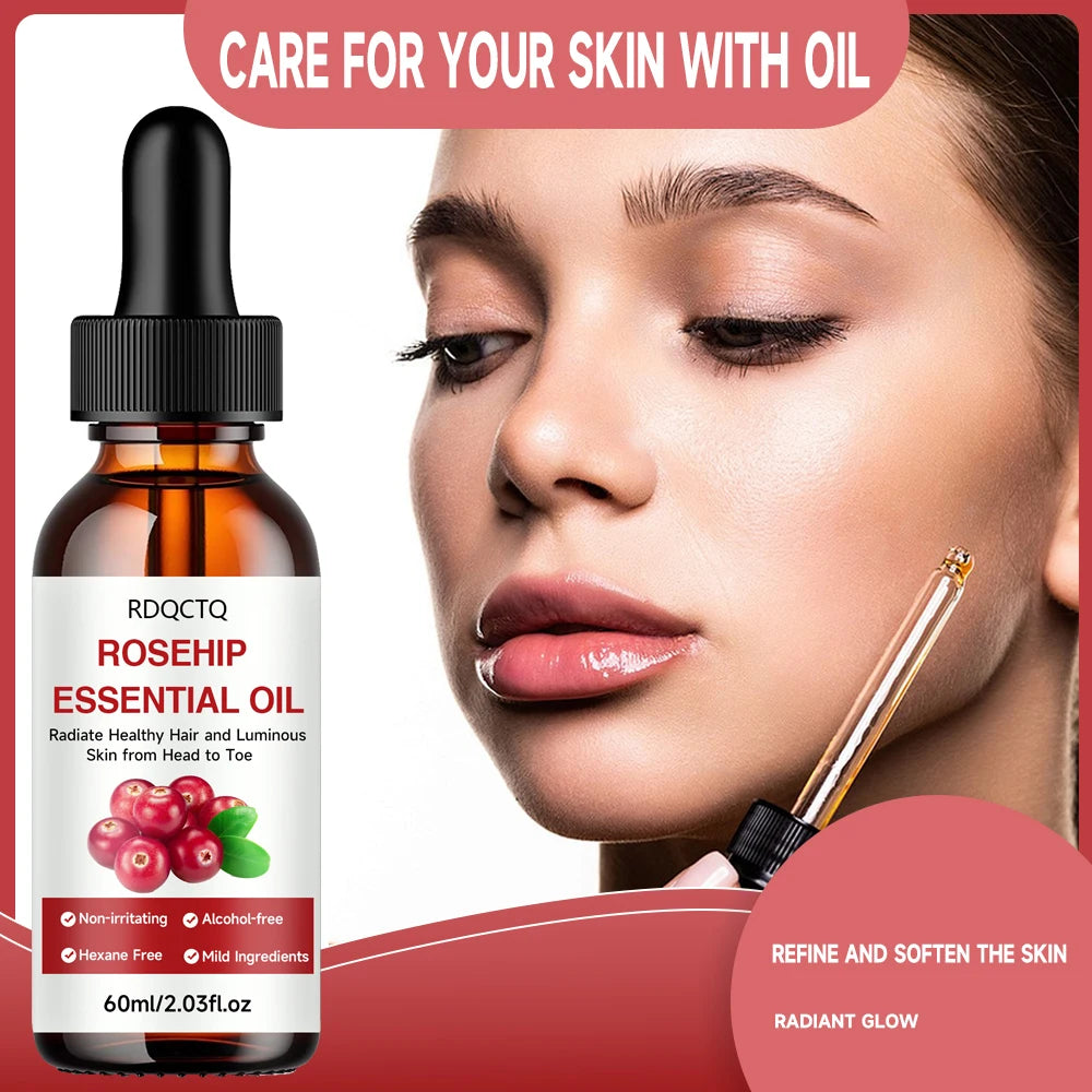 Rose Hip Oil for Hair & Skin - Pure Natural Moisturizing Essential Oil, Alcohol-Free, Nourishing Care for Healthy Look