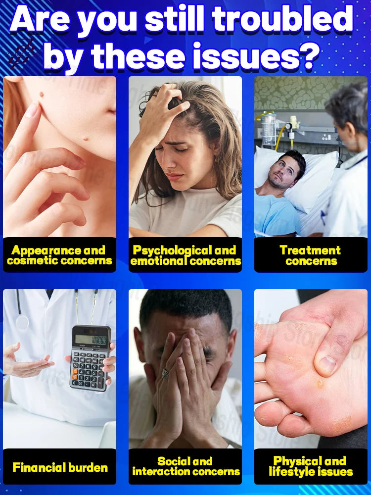 Bestselling  ᵇˡᵘᵉ ˡⁱᵍʰᵗ ᵖᵉⁿ ᶠᵒʳ ʷᵃʳᵗ ʳᵉᵐᵒᵛᵃ and treatment, latest 2025 model
