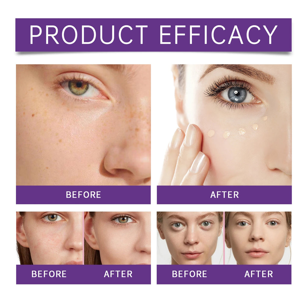 Concealer Improve Skin Elasticity Brighten Complexion Not Easy Remove Makeup Moisturizing Liquid Lightweight Dark Circle Blemish