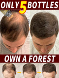 Hot selling liquid filled device, awaken hair follicles, make the top of the head more luxuriant, hair tools,