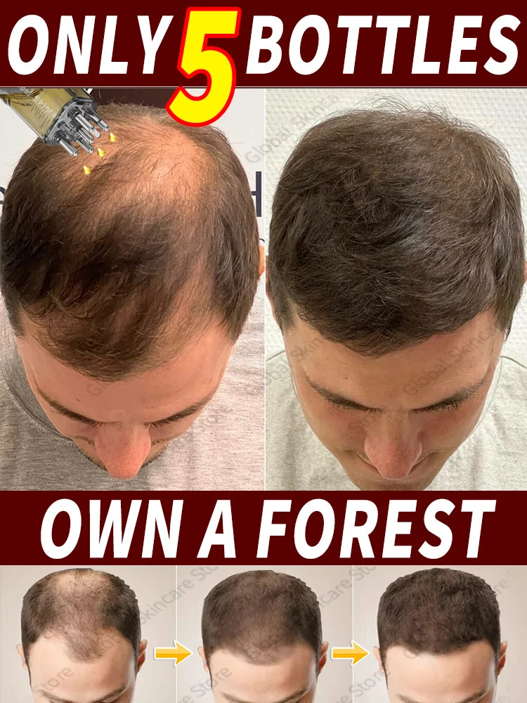 Hot selling liquid filled device, awaken hair follicles, make the top of the head more luxuriant, hair tools,