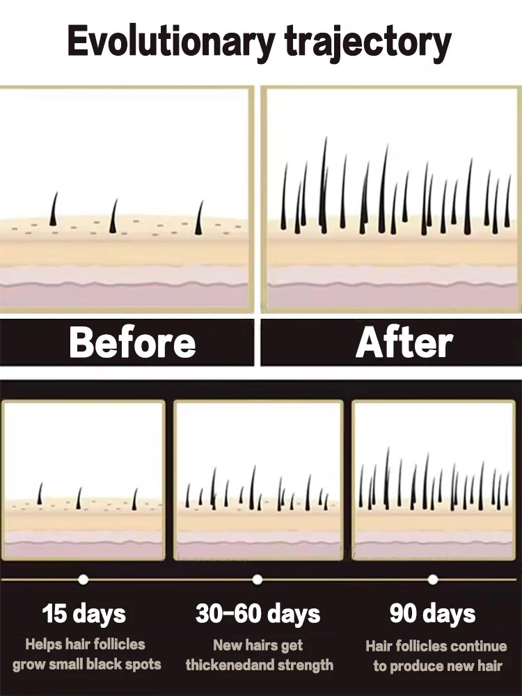 Hot selling liquid filled device, awaken hair follicles, make the top of the head more luxuriant, hair tools,