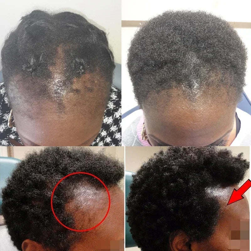 99% of buyers buy again, have more and more hair, say goodbye to baldness, thick hair,Hot selling product