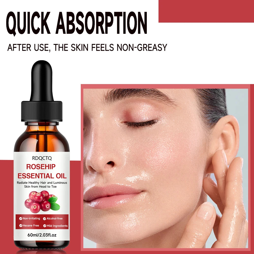 Rose Hip Oil for Hair & Skin - Pure Natural Moisturizing Essential Oil, Alcohol-Free, Nourishing Care for Healthy Look