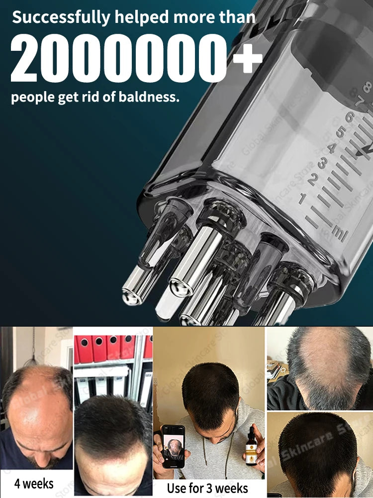 Hot selling liquid filled device, awaken hair follicles, make the top of the head more luxuriant, hair tools,