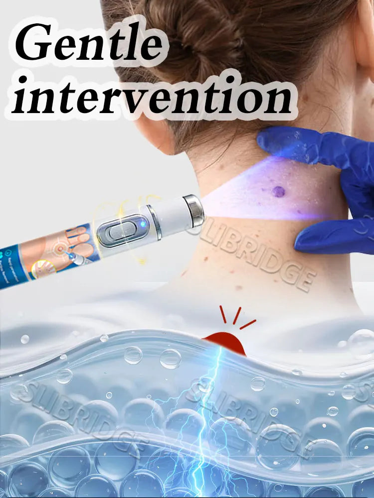 Latest upgraded blue light pen, best-selling wart care