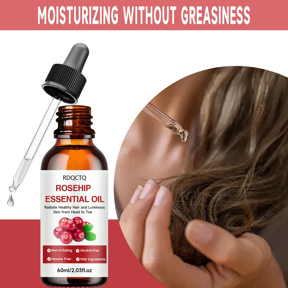 Rose Hip Oil for Hair & Skin - Pure Natural Moisturizing Essential Oil, Alcohol-Free, Nourishing Care for Healthy Look